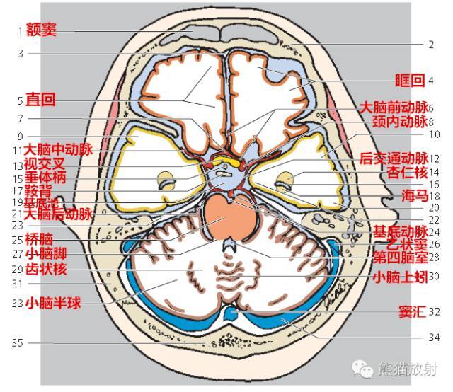 【解剖入门】颅脑ct断层(中英文对照)