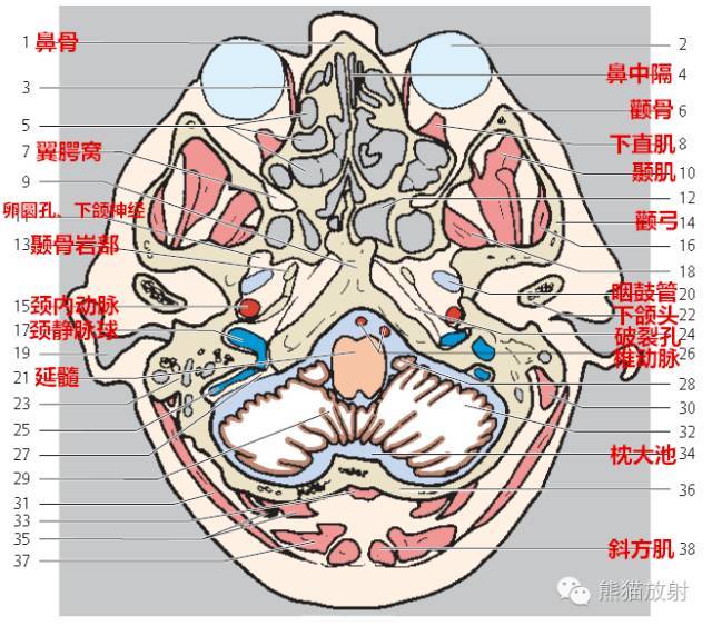 【解剖入门】颅脑ct断层(中英文对照)