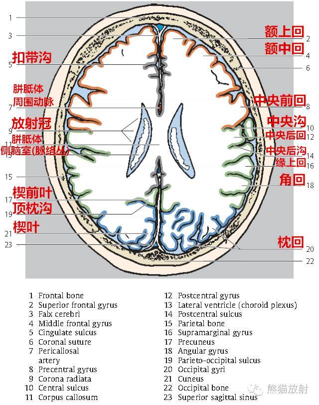 【解剖入门】颅脑ct断层(中英文对照)