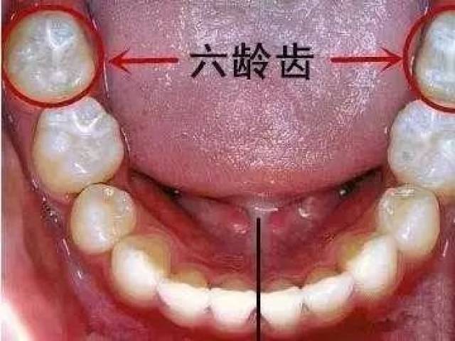 家长再不注意孩子牙齿就彻底毁