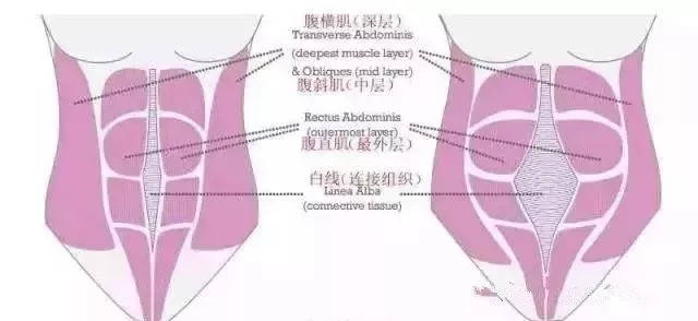 【康复干货】产后康复训练之腹直肌分离