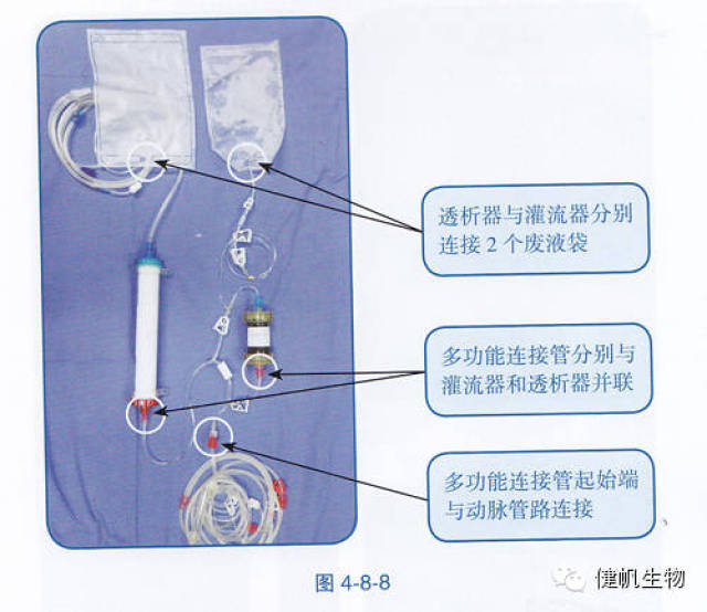 多功能连接管起始端与动脉管路连接,再与灌流器和透析器并联,透析器与