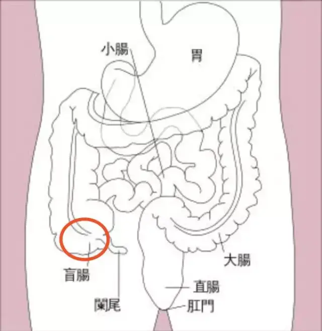 一键康「每日"医"案」盲肠炎是阑尾炎吗?一定要开刀吗?