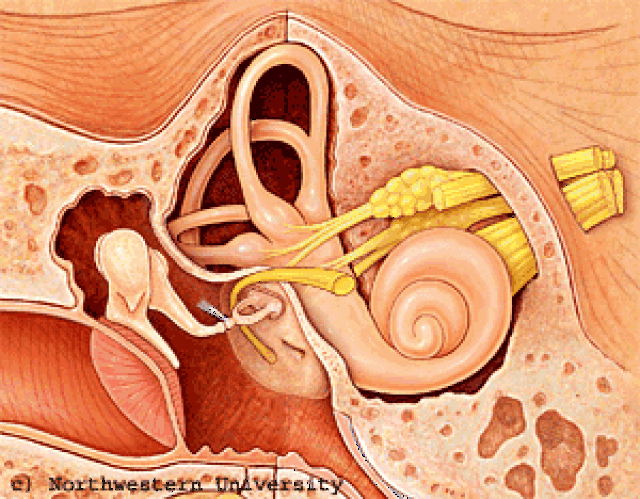 各种中耳病变,其鼓室图有什么特点?