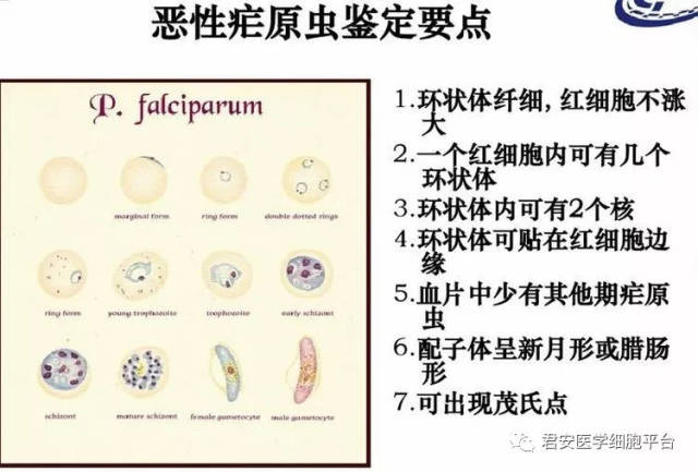 「间日疟原虫雌配子体」 形态特征:感染虫体的红细胞涨大,外形规整