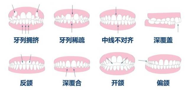 淮安38个护牙小知识 :牙齿不齐,根管治疗,洗牙,拔牙.