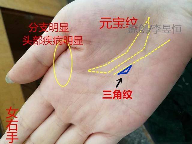 手相中元宝纹和三角纹同时出现,钱财无忧!