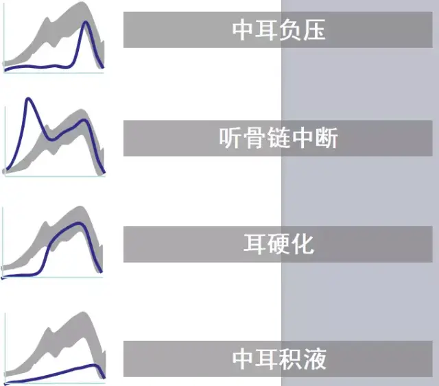 该结果提示这个病人 听骨链有中断的可能.