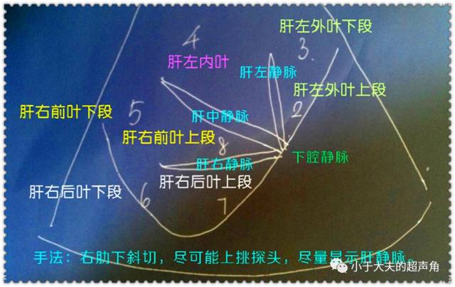 肝脏右肋下斜切面:肝右叶分段示意图.