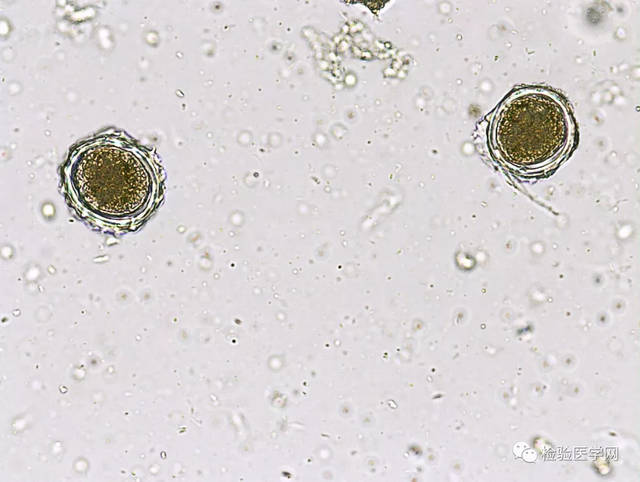 图7-5 钩虫卵