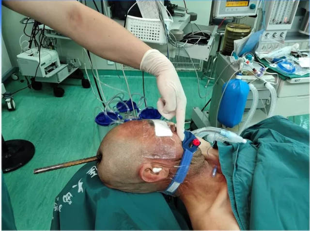 [案例解读]西京医院成功救治一名钢筋颅脑贯穿伤患者