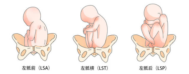 不同胎位的宝宝都是什么样的?太可爱了