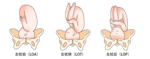 最常见的胎位有:顶先露,臀先露,面先露和肩先露. 1.