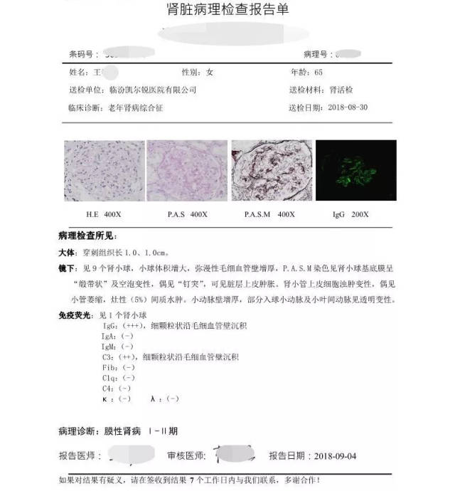 王女士肾脏病理检查报告单