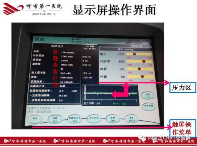 图解crrt治疗全过程,一看保证能学会(金宝)!