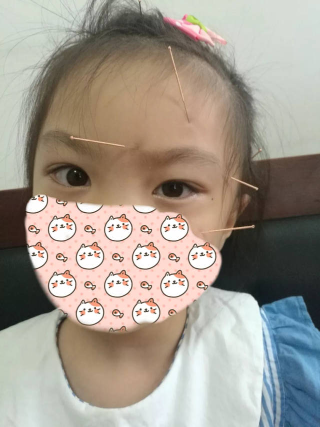 取下皮肤针,结束所有的治疗.喵喵的眼睛恢复正常了!