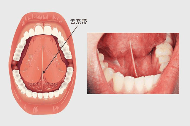 语你同行:大舌头语言矫正六部训练法