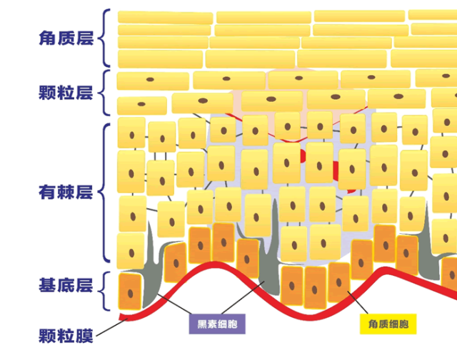 做多了光子嫩肤是否会角质层变薄,皮肤