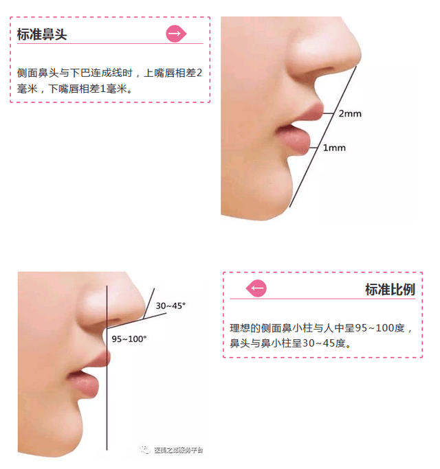 好看的鼻子要符合6个美学维度 长度, 宽度, 高度, 鼻头大小, 鼻孔形状