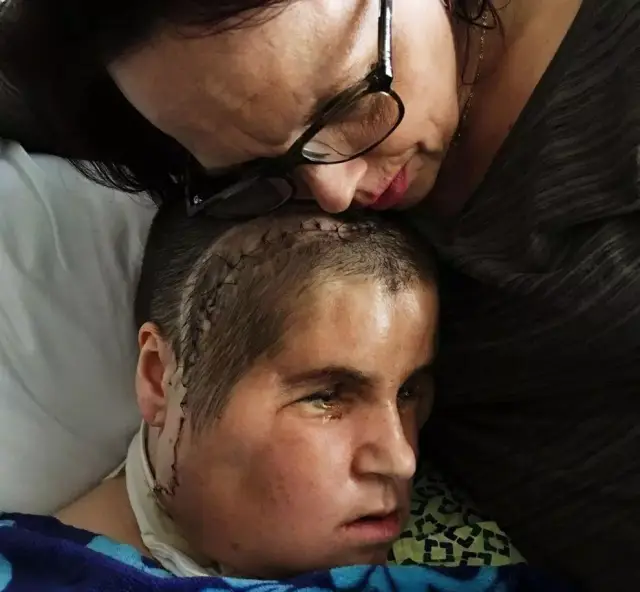 自毁容貌症 搜狐网