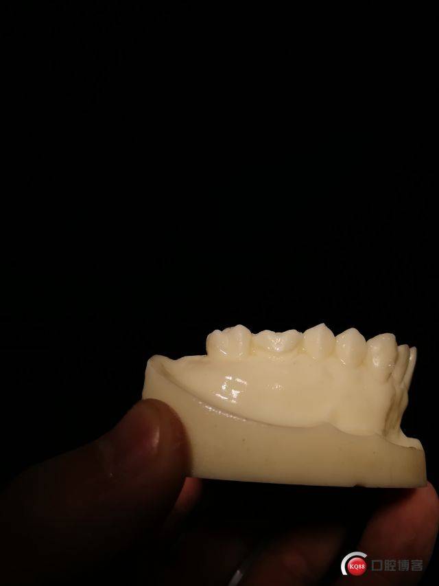 硅橡胶备牙导板的初次制作