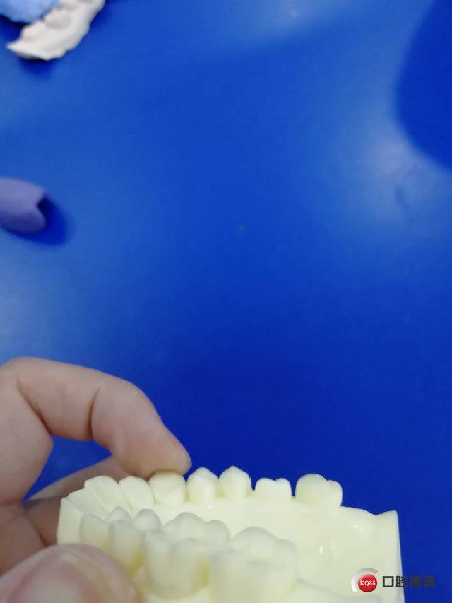 硅橡胶备牙导板的初次制作