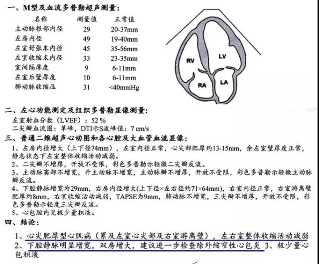 hr:52次/分,心律绝对不齐,各瓣膜区未闻及病理性杂音,移动性浊音)