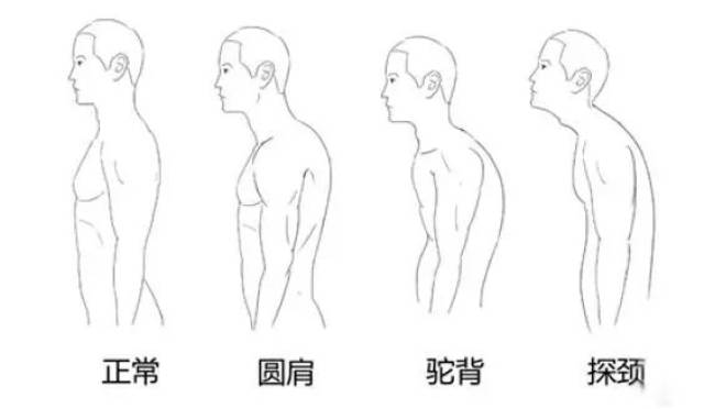 圆肩驼背猥琐颈?一个瑜伽动作帮你全搞定!