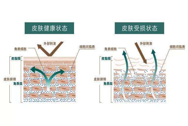 在角质层里,角质细胞与细胞间脂质以类似砖墙结构形式排列,构成稳定