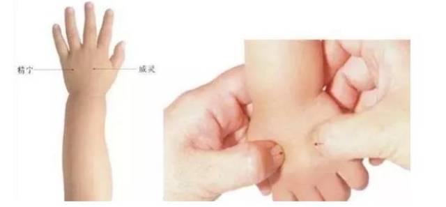 穴位:精宁位于手背第四,五掌骨的缝隙间;威灵位于手背第二,三掌骨的