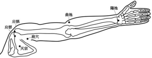 艾灸盒就可以, 阿是穴(即局部疼痛部位)肩井,天宗以及手臂上的肩髎