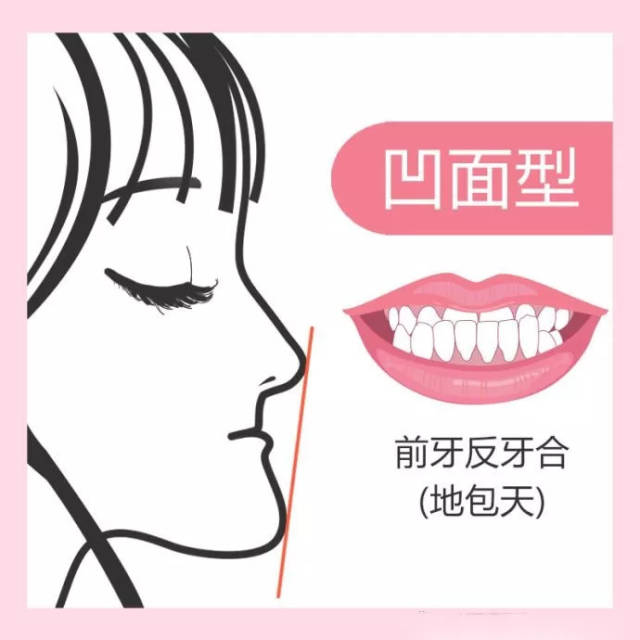 除此之外,父母要注意看一下儿童的颌面部发育情况,有些小孩有明显的