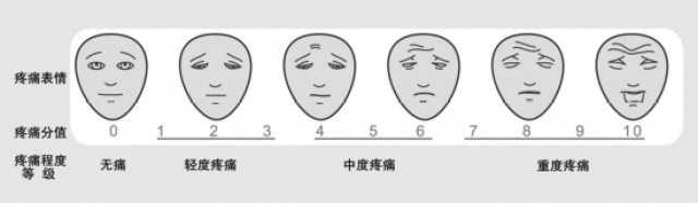 图2.面部表情疼痛评分量表