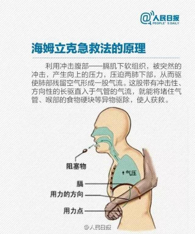 吸入异物后突然发生剧烈呛咳,憋气,呼吸困难,气喘声嘶,面色绀紫