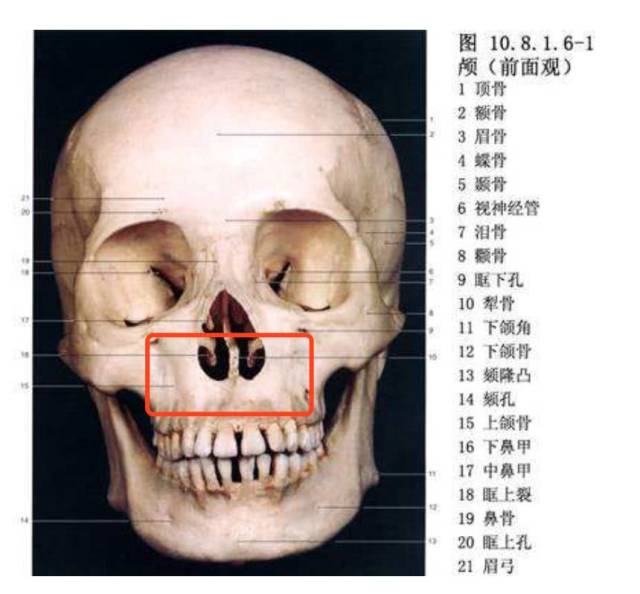 让蒋依依只能笑不能丧脸的原因主要是她的上颌骨有一些凹陷,就是下图