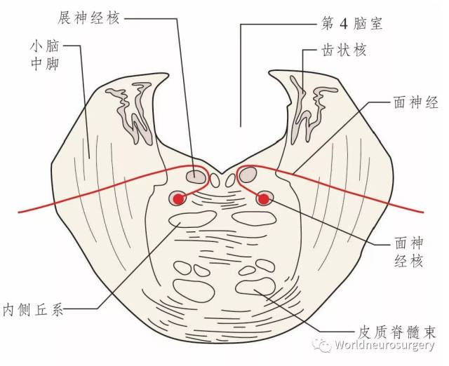 21 经脑桥水平切面.显示面神经核及面神经在脑干内的走行.