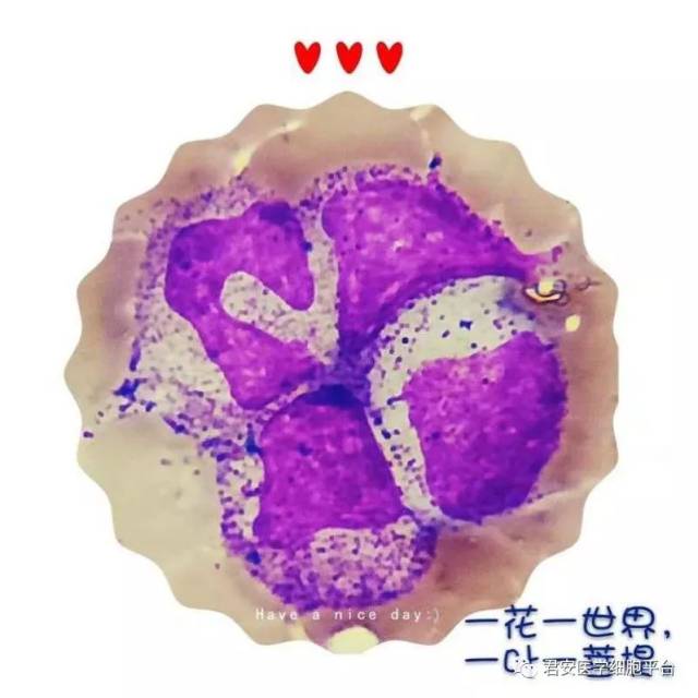 含中毒颗粒的中性粒细胞