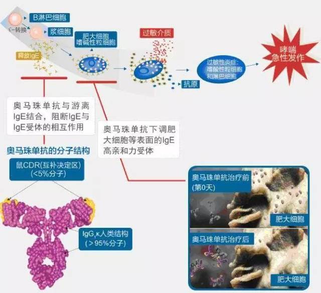 奥马珠单抗—我就是"药神"!过敏性哮喘孩子可以不用依赖激素了!