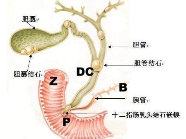 胆管炎,急性胆囊炎,急性腐蚀性胃炎,急性阑尾炎,急性胃肠炎,急性胰腺