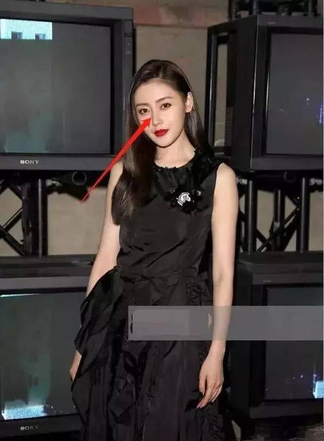 秦岚,王媛可,张天爱未p图流出,为何纷纷出现"吸管鼻"?