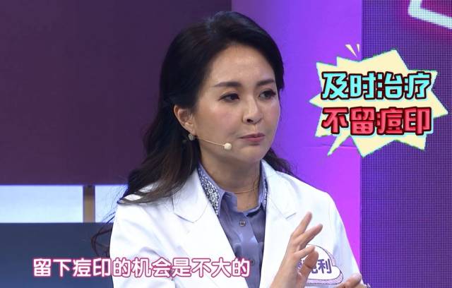 节目 | 她现场示范挤脓包痘的正确姿势,竟然引起