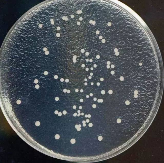 菌落总数是什么 菌落其实就是我们常说的细菌,菌落总数则是一个卫生