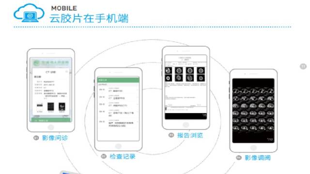 医学影像云