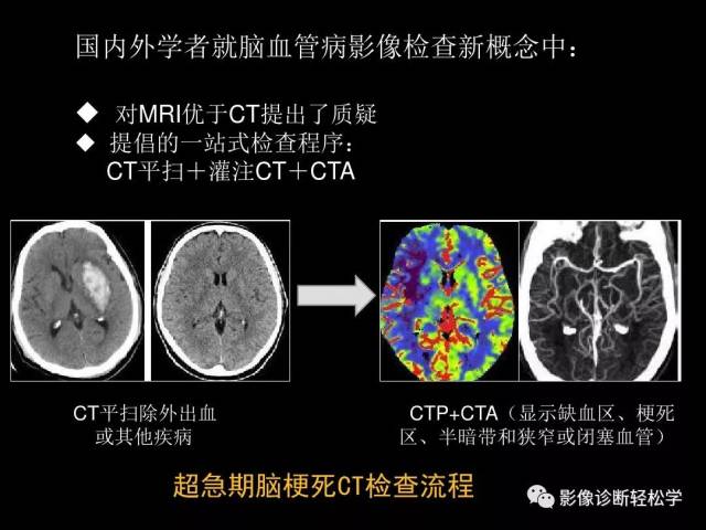 缺血性脑血管病的CT、MR灌注成像