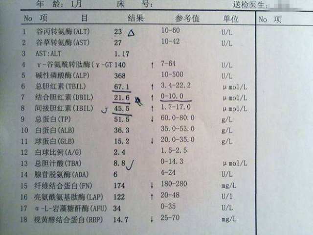 肝炎最怕一物,喝水放一些,降低胆红素,癌细胞躲着你走