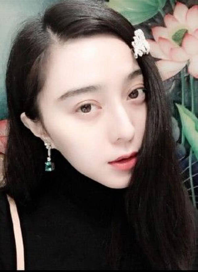 女明星的黑眼圈有多严重?素颜老10岁!3个步骤分清黑眼圈类型
