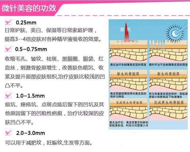 美度医美|黄金微针真的那么有效果吗