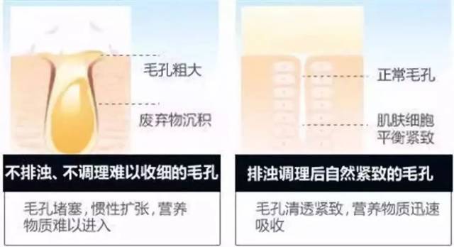 肌肤老化形成的水滴型毛孔:随着年龄的增长,皮肤细胞老化,新陈代谢