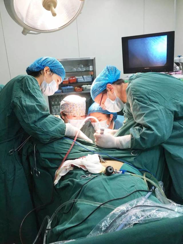 妇产科团队成功开展腹腔镜下阴式子宫全切术