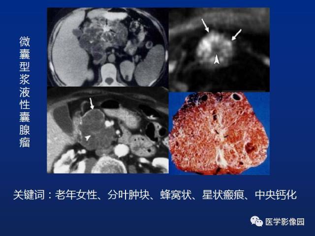 胰腺占位性病变,等你分析 | 读片专栏907期